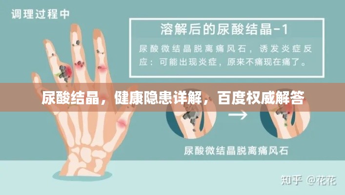 尿酸结晶，健康隐患详解，百度权威解答